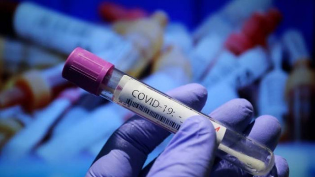 Служител на АЕЦ „Козлодуй” е с положителна проба за COVID-19